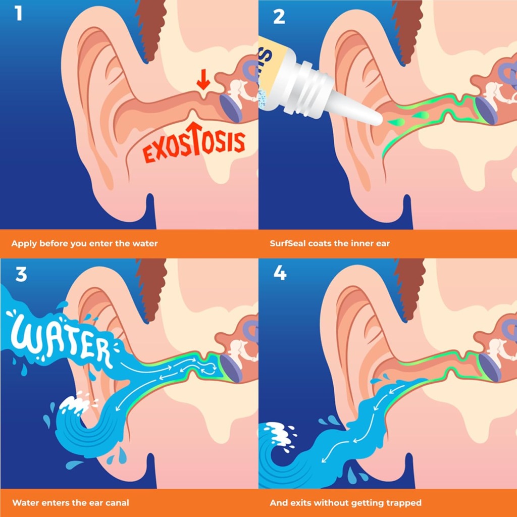 SwimSealTM Twin-Pack All Natural Swimmer's Ear Drops for Daily Use Rather Than Alcohol Drops or Earplugs. The Solution for Your Ears for All Water Exposure for All Ages. - Damaged Box - BBE 11/2028