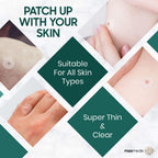 Wart & Corn Remover Patches - 28 Pack - Salicylic Acid Treatment for Hands & Feet - Verruca Removal Pads - Damaged Box