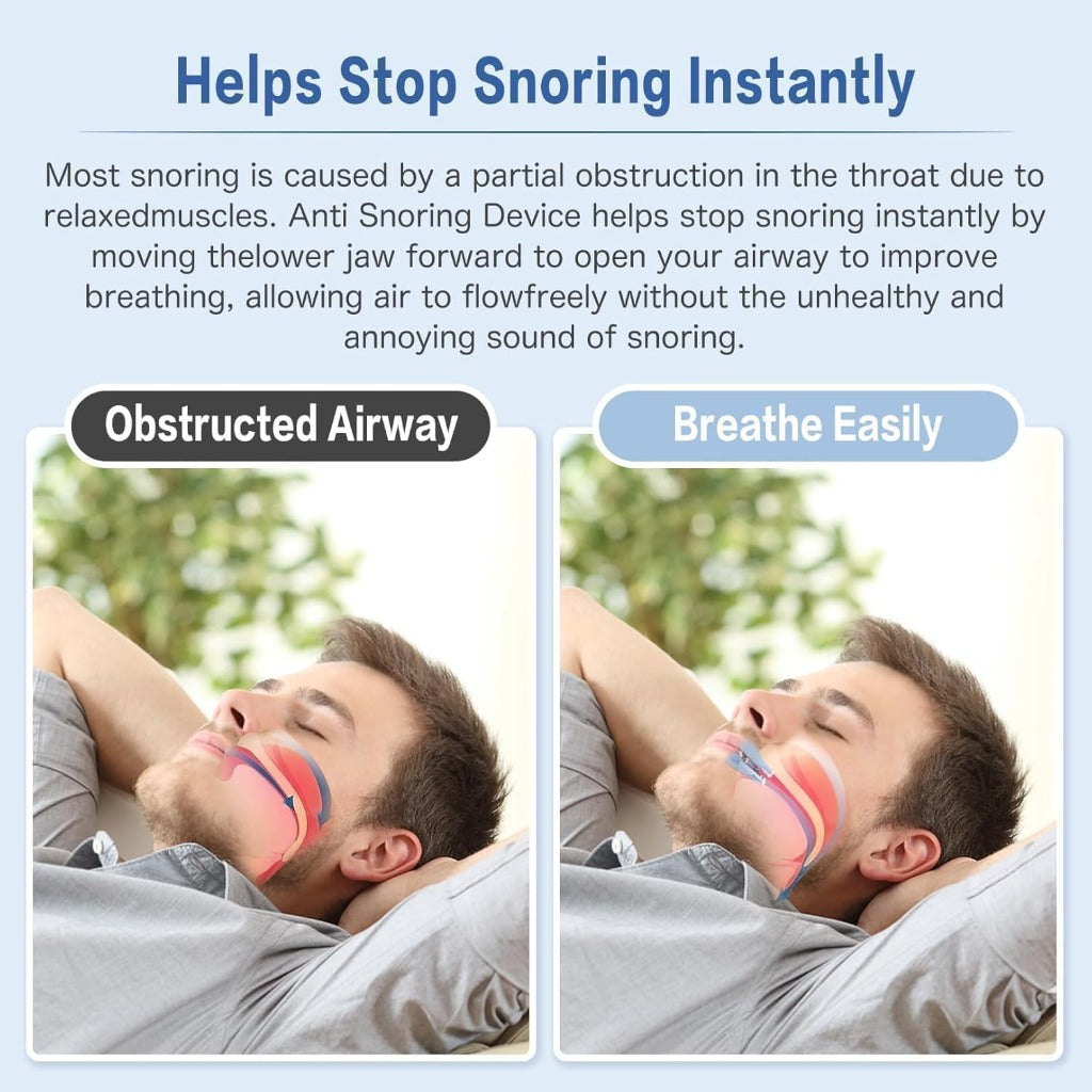 Anti Snoring Mouth Guard - Adjustable Sleep Apnea Snore Stopper Mouthpiece Device for Sleeping - Damaged Box