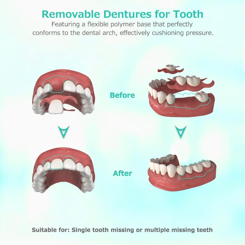 Custom Partial Dentures Removable False Teeth Top Bottom Smile Fit 2 Teeth - Good Hapefeey