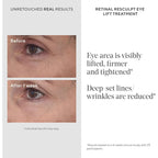 Murad Retinal ReSculpt Eye Lift Treatment Anti Aging Eye Cream - New Murad