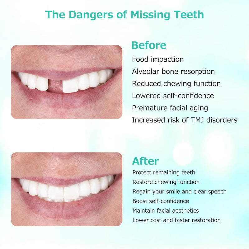 Custom Partial Dentures Removable False Teeth Top Bottom Smile Fit 2 Teeth - Good Hapefeey