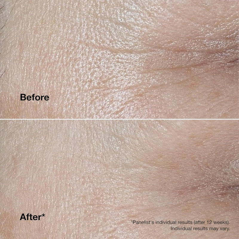 Clinique Smart Clinical Repair Wrinkle Cream Hydrating Anti Ageing - New The Outlet Shop