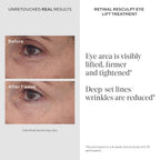 Murad Retinal ReSculpt Eye Lift Treatment - Resurgence Anti-Aging Eye Cream - Vitamin A - 0.5 fl oz - New