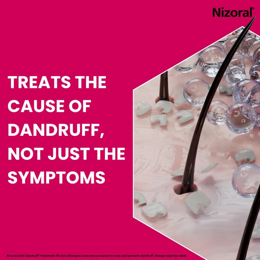 Nizoral Anti-Dandruff Treatment Shampoo, Treats and Prevents Dandruff, Clinically Proven to Control Itchy & Flaky Scalps, Contains Ketoconazole, 1 x 60ml - BBE 11/2028 Nizoral