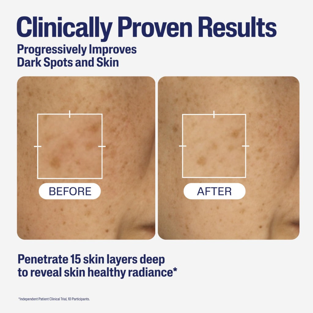 Cetaphil Healthy Radiance Brightening Serum with Niacinamide for Skin Pigmentation, 30ml, Packaging May Vary