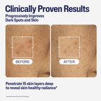 Cetaphil Healthy Radiance Brightening Serum with Niacinamide for Skin Pigmentation, 30ml, Packaging May Vary