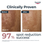 Eucerin Anti-Pigment Dual Face Serum 30ml, Hyperpigmentation Treatment for Age Spots and Uneven Skin Tone, Advanced Anti-Pigment Face Serum for Women with Hyaluronic Acid - Very Good