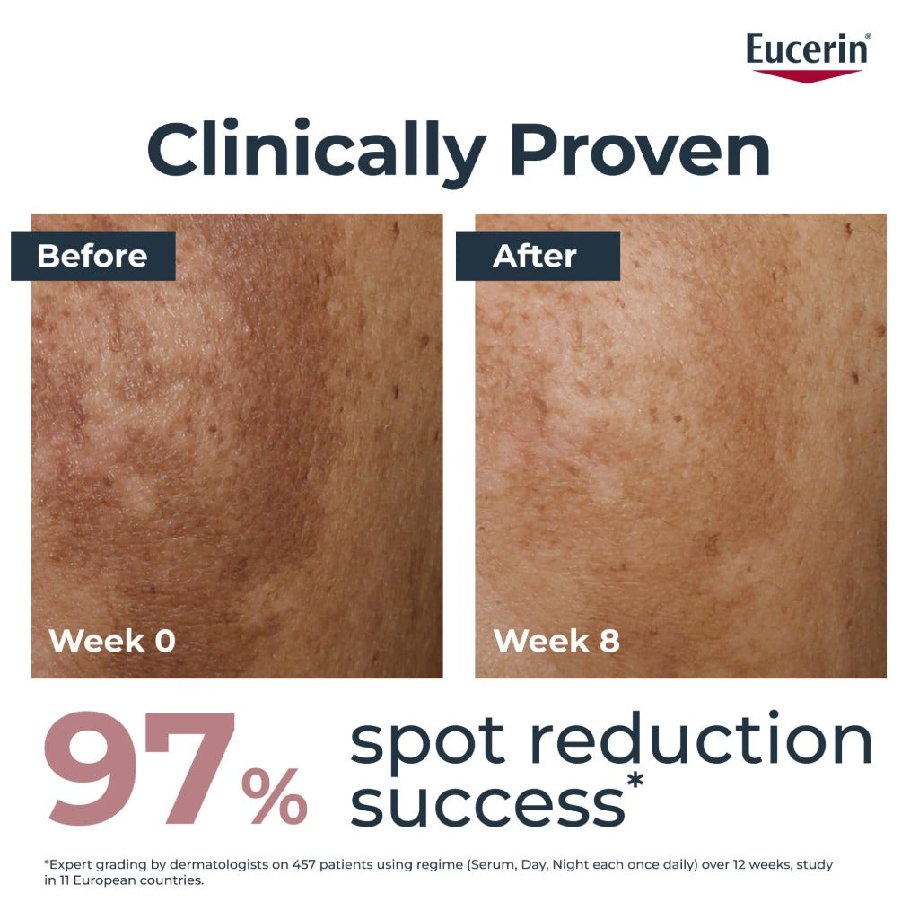 Eucerin Anti-Pigment Dual Face Serum 30ml, Hyperpigmentation Treatment for Age Spots and Uneven Skin Tone, Advanced Anti-Pigment Face Serum for Women with Hyaluronic Acid - Very Good