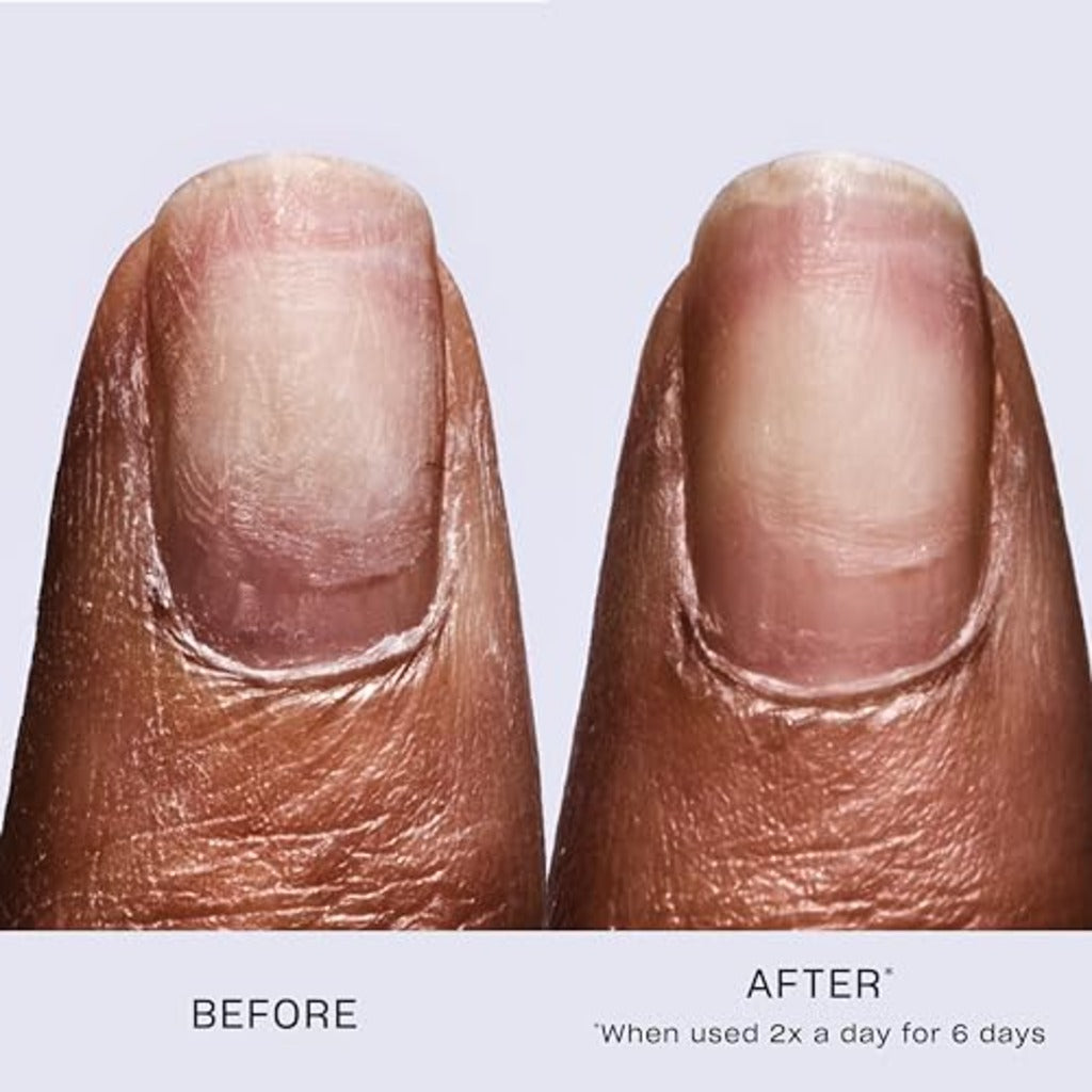 OPI Repair Mode Nail Polish Nail Repair and Strengthening Vegan Formula, Patented Bond Building Nail Serum Repairing 99% Of Nail Keratin, Professional Nail Strengthener for Damaged Nails, 9ml