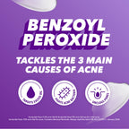 Acnecide Face Gel 5% Benzoyl Peroxide 15g Targeted Acne Treatment for Spots and Breakouts Tube - Damaged Box