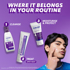 Acnecide Face Gel 5% Benzoyl Peroxide 15g Targeted Acne Treatment for Spots and Breakouts Tube - Damaged Box
