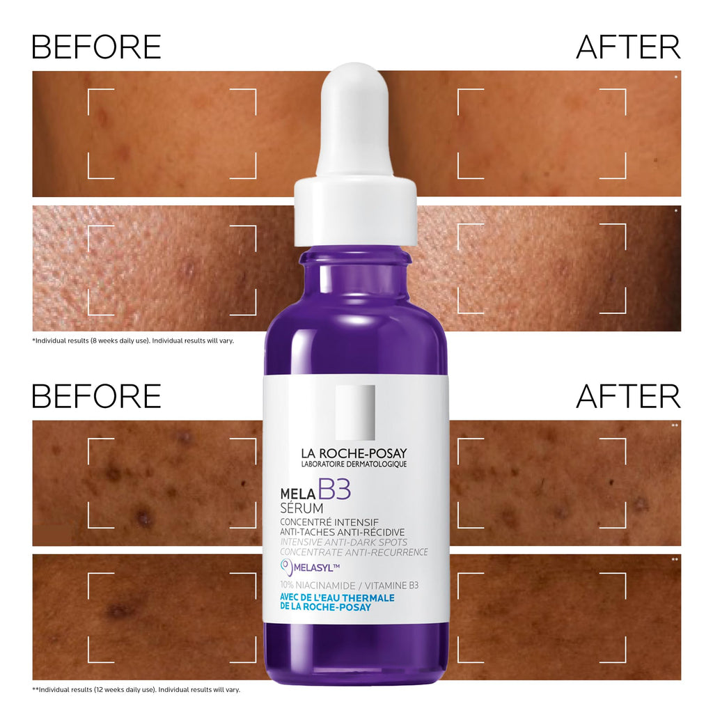 La Roche-Posay Mela B3 Serum, Intense Anti-Dark Spot Face Serum, Hyperpigmentation Treatment, Multi-Patented Melasyl, 10% Niacinamide, Post-Acne Marks Reducer For Sensitive Skin, 30ml - Damaged Box