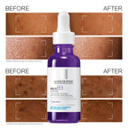La Roche-Posay Mela B3 Serum, Intense Anti-Dark Spot Face Serum, Hyperpigmentation Treatment, Multi-Patented Melasyl, 10% Niacinamide, Post-Acne Marks Reducer For Sensitive Skin, 30ml - Damaged Box