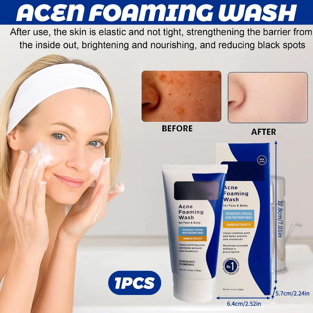 Acne Foaming Wash, Face Cleanser for Acne Treatment, Back Acne Body Wash, Daily Facial Cleanser for Back Acne and Face, 156g