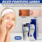 Acne Foaming Wash, Face Cleanser for Acne Treatment, Back Acne Body Wash, Daily Facial Cleanser for Back Acne and Face, 156g