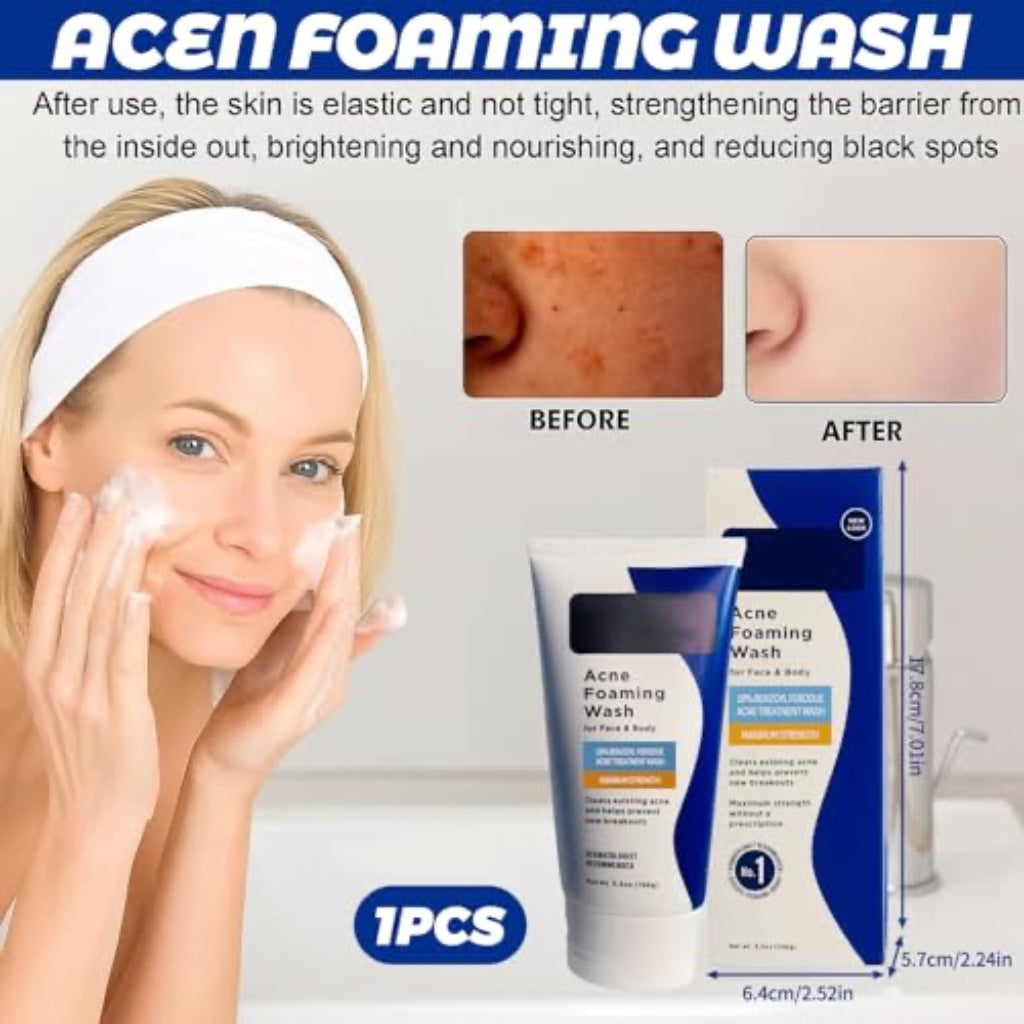 Acne Foaming Wash, Face Cleanser for Acne Treatment, Back Acne Body Wash, Daily Facial Cleanser for Back Acne and Face, 156g