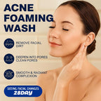 Acne Foaming Wash, Face Cleanser for Acne Treatment, Back Acne Body Wash, Daily Facial Cleanser for Back Acne and Face, 156g