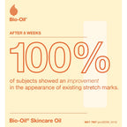 Bio Oil Body Skin Care Oil (125ml) - Firming Skincare That Reduces Appearance Of Stretch Marks & Scars - Grease Free Moisturiser Lotion - With Vitamin E & Vitamin A - Damaged Box