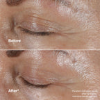 Clinique Smart Clinical Repair Wrinkle Correcting Eye Cream With Hyaluronic Acid + Peptides | Anti-Ageing, Hydrating + Depuffing With Massage