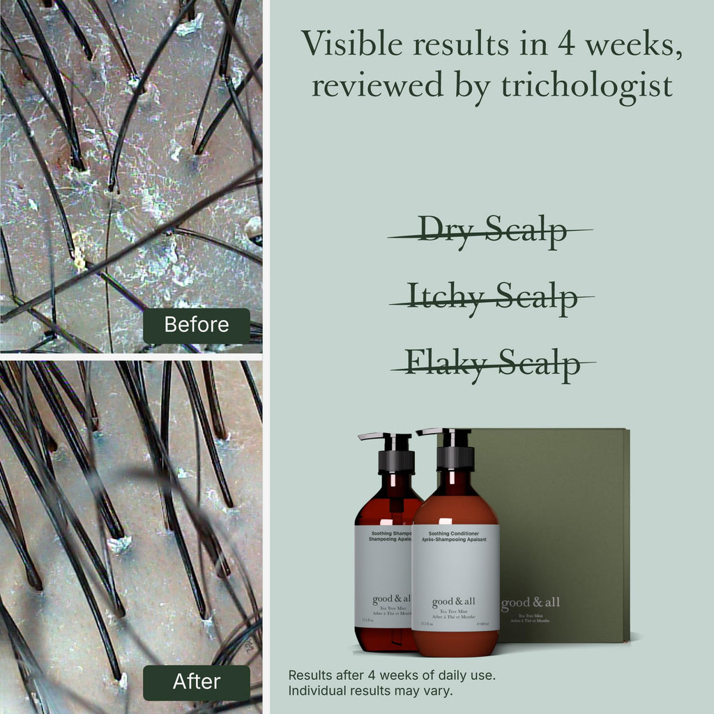Good&All Tea Tree Shampoo and Conditioner Set for Dry Itchy Scalp with Peppermint - Sodium Lauryl Sulfate/Sulphate, Silicone, Paraben, Fragrance Free - 400ml