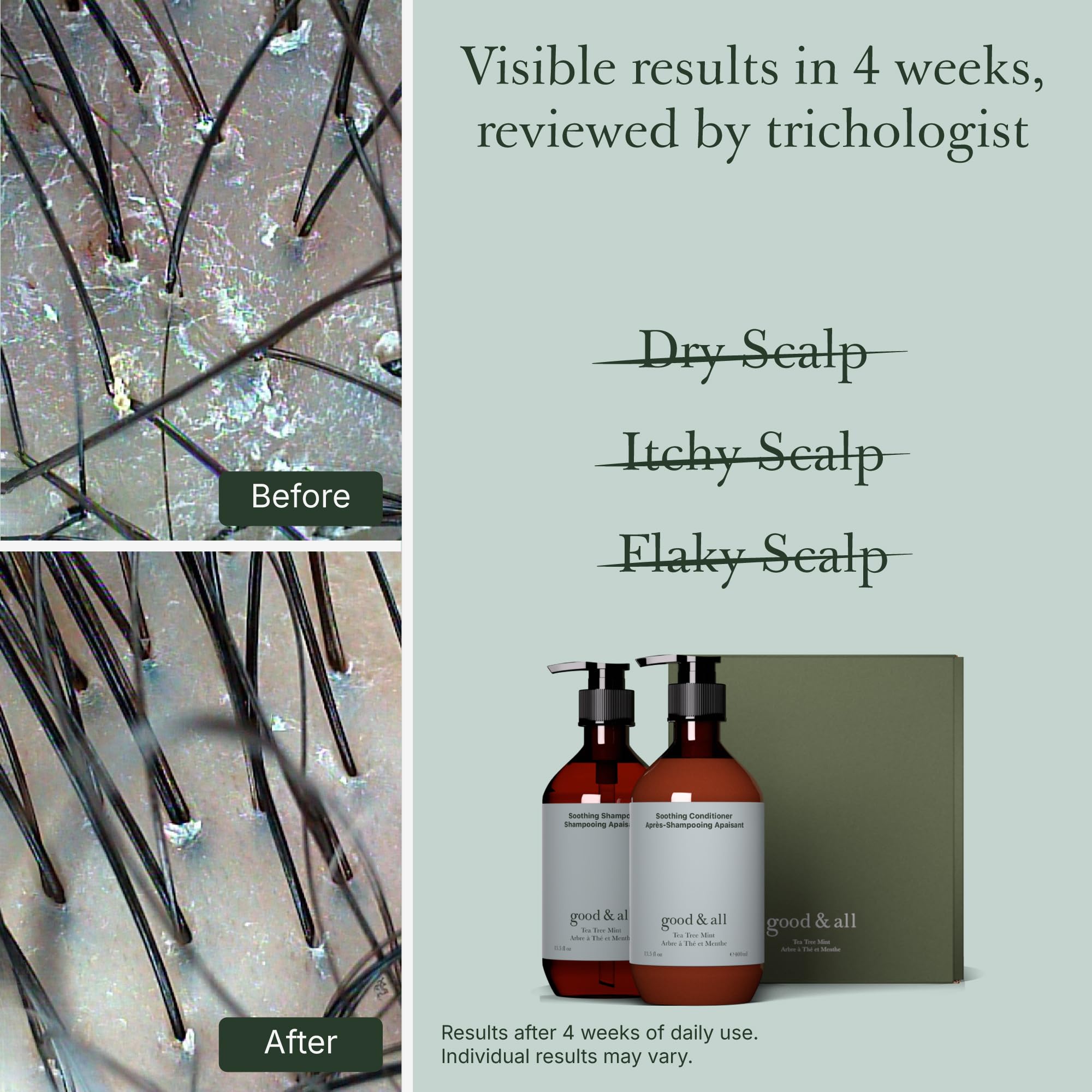 Good&All Tea Tree Shampoo and Conditioner Set for Dry Itchy Scalp with Peppermint - Sodium Lauryl Sulfate/Sulphate, Silicone, Paraben, Fragrance Free - 400ml