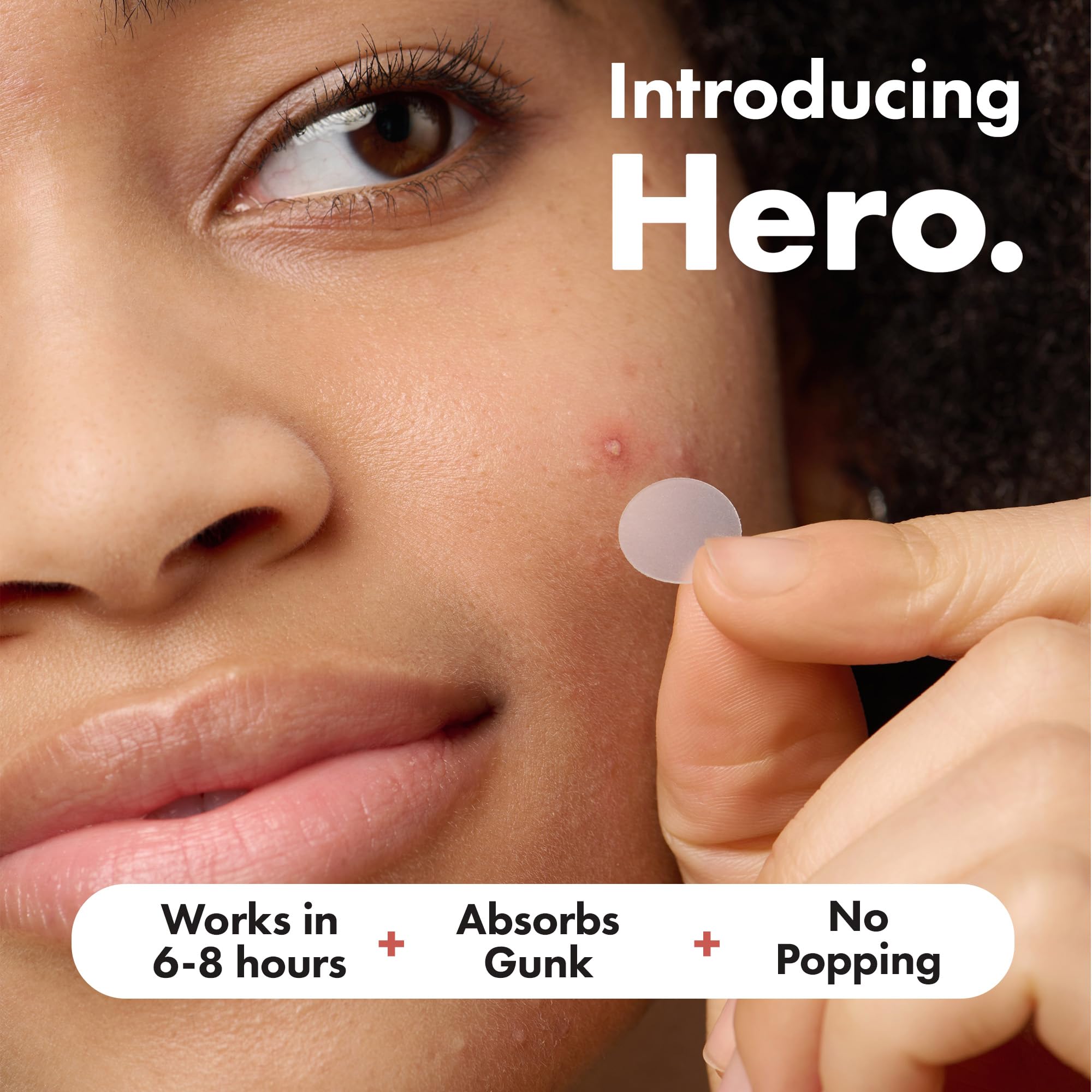 Mighty Patch Original Spot Patches by Hero Cosmetics, Day & Night Time Acne Treatment, Clear Spot Remover Hydrocolloid Patches, Anti Acne Dots, Spot Treatment Pimple Stickers - 36 Patches - Damaged Box