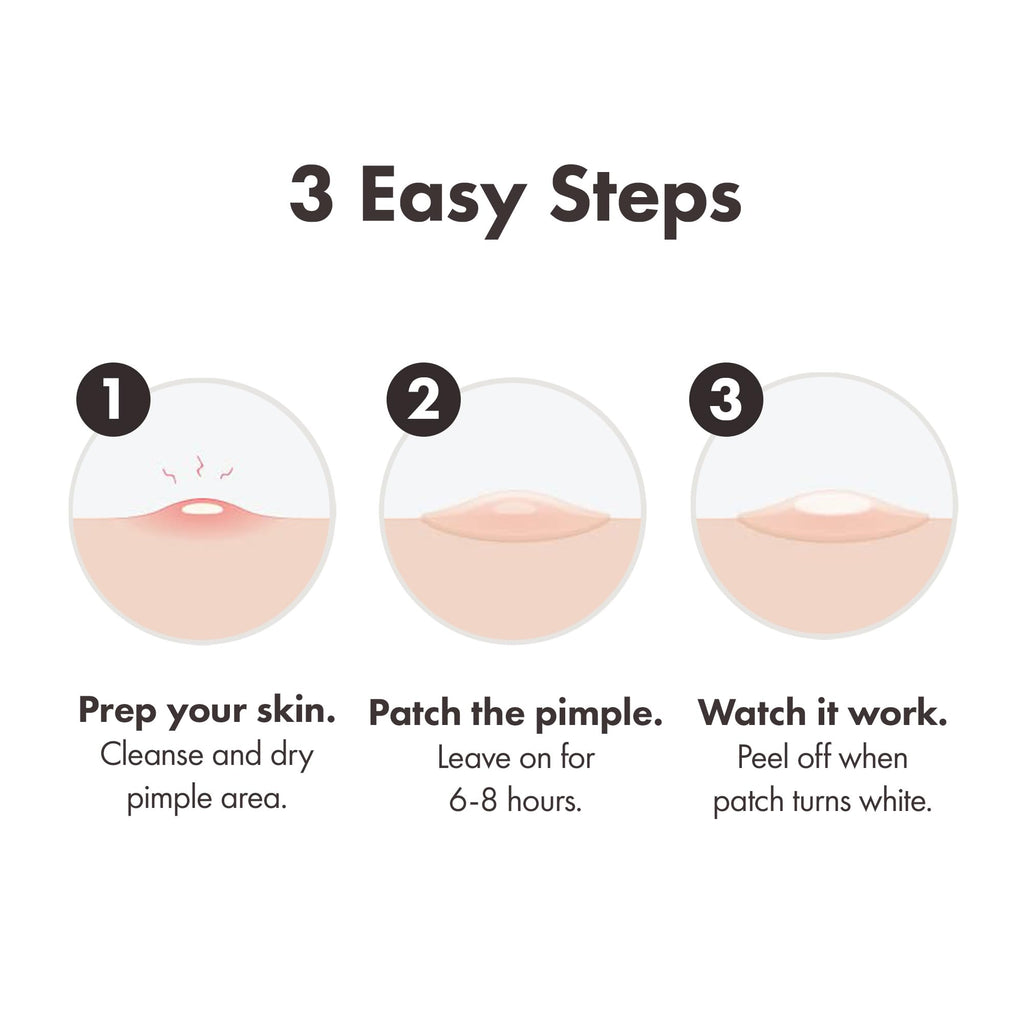 Mighty Patch Original Spot Patches by Hero Cosmetics, Day & Night Time Acne Treatment, Clear Spot Remover Hydrocolloid Patches, Anti Acne Dots, Spot Treatment Pimple Stickers - 36 Patches - Damaged Box