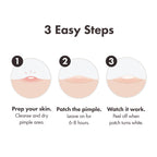 Mighty Patch Original Spot Patches by Hero Cosmetics, Day & Night Time Acne Treatment, Clear Spot Remover Hydrocolloid Patches, Anti Acne Dots, Spot Treatment Pimple Stickers - 36 Patches - Damaged Box