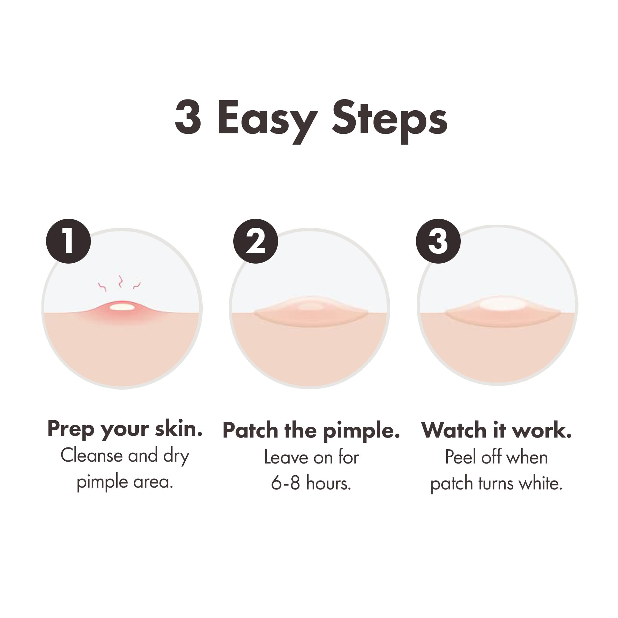 Mighty Patch Original Spot Patches by Hero Cosmetics, Day & Night Time Acne Treatment, Clear Spot Remover Hydrocolloid Patches, Anti Acne Dots, Spot Treatment Pimple Stickers - 36 Patches - Damaged Box