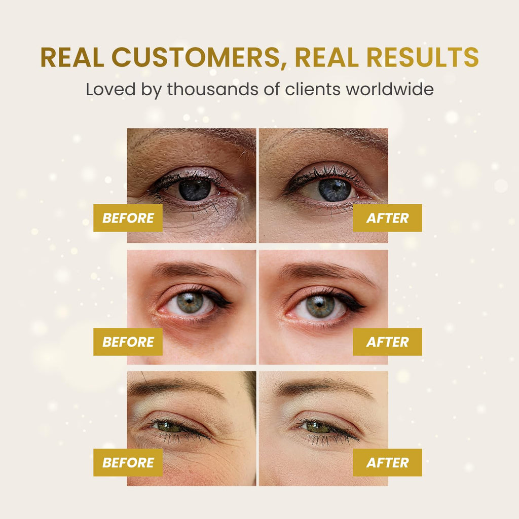 PLANTIFIQUE 24K Gold Under Eye Gel Patches - Dermatologist Tested - 20 Pairs Collagen & Hyaluronic Acid Eye Masks for Dark Circles, Bags & Puffiness