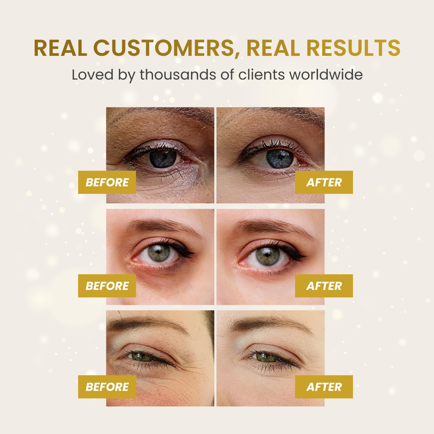 PLANTIFIQUE 24K Gold Under Eye Gel Patches - Dermatologist Tested - 20 Pairs Collagen & Hyaluronic Acid Eye Masks for Dark Circles, Bags & Puffiness