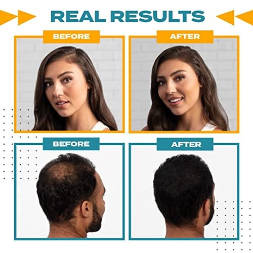 Toppik Spray Applicator, Precise Fibre Application on Thinning Hair for Naturally Thicker Looking Hair, Suitable for 12g & 27.5 g Bottle Sizes - Damaged Box