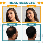 Toppik Spray Applicator, Precise Fibre Application on Thinning Hair for Naturally Thicker Looking Hair, Suitable for 12g & 27.5 g Bottle Sizes - Damaged Box