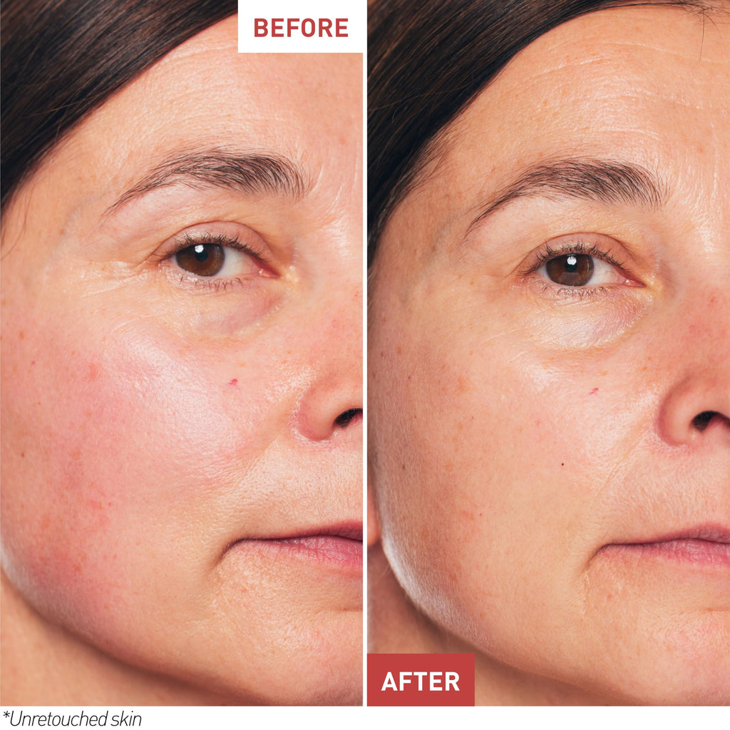Erborian - Skin Therapy - Multi-perfektionierendes Gesichts"ol - Reduziert Anzeichen von M"udigkeit - F"ur alle Hauttypen geeignet - Koreanische Kosmetik - 10 ml - Damaged Box