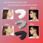 Jaw Exerciser,Jaw Toner for Jawline,Jaw Trainer Chisel Your Jawline,3pack of Jawline Trainer,Jawline Exerciser Chew(40lbs+50lbs+60lbs) - Damaged Box