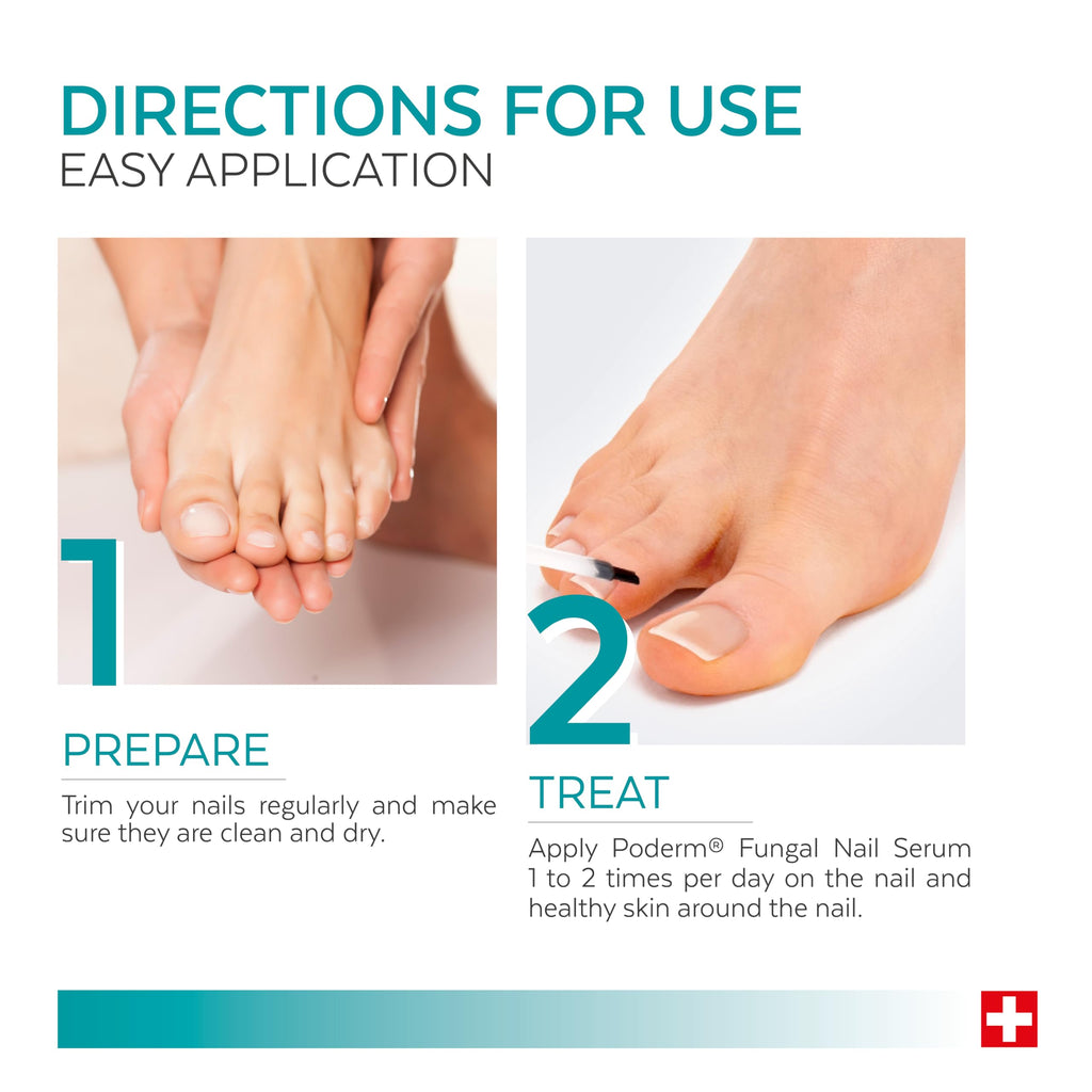PODERM - FUNGAL NAIL TREATMENT - Nail Fungus Treatment for Toenail - Exceptional and Powerful Plants Anti-Fungal Restorative Properties - Professional Foot/Hand Treatment - Quick&Easy - Swiss Made - Damaged Box