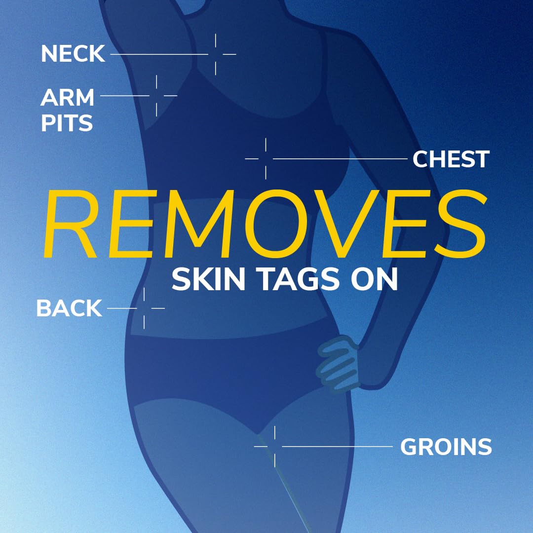 Scholl Freeze Away Skin Tag Removal Kit - Removes Skin Tags in As Little As 1 Treatment - Safe and Effective Skin Tag Remover - Clinically Proven, 12 Treatments - Damaged Box - BBE 04/2028