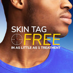 Scholl Freeze Away Skin Tag Removal Kit - Removes Skin Tags in As Little As 1 Treatment - Safe and Effective Skin Tag Remover - Clinically Proven, 12 Treatments - Damaged Box - BBE 04/2028