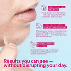 Bl'em'e Pimple Patches - 120 Clear Invisible Ultra-Thin Hydrocolloid Dots - Acne Spot Treatment - Korean Skincare - Damaged Box