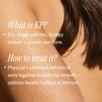 First Aid Beauty KP Bump Eraser Body Scrub 10% AHA 226g 8oz Strawberry Exfoliating Treatment for Keratosis Pilaris and Chicken Skin Bumps - Damaged Box