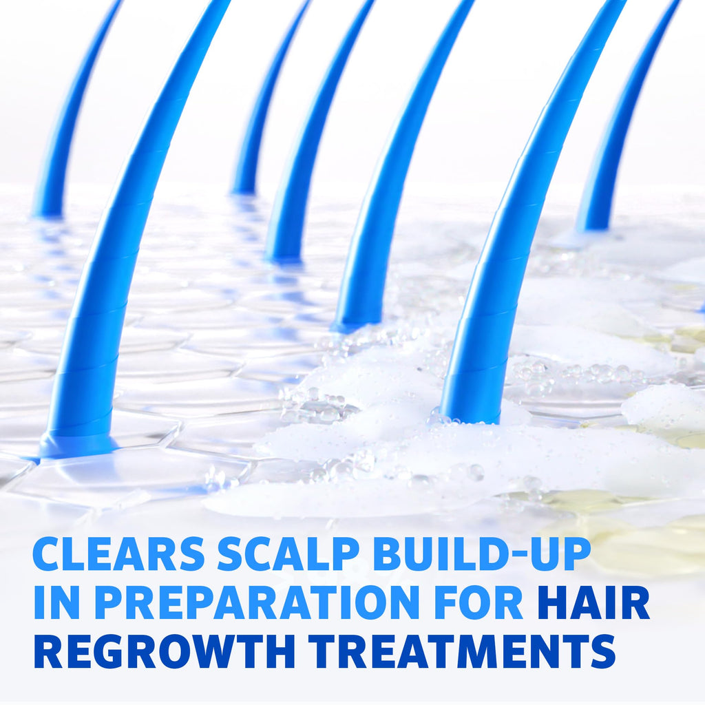 Regaine Pre-Growth 2in1 Shampoo & Conditioner 248ml - Triple Acid Complex for Hair Regrowth Treatment Prep - Damaged Box