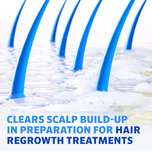 Regaine Pre-Growth 2in1 Shampoo & Conditioner 248ml - Triple Acid Complex for Hair Regrowth Treatment Prep - Damaged Box