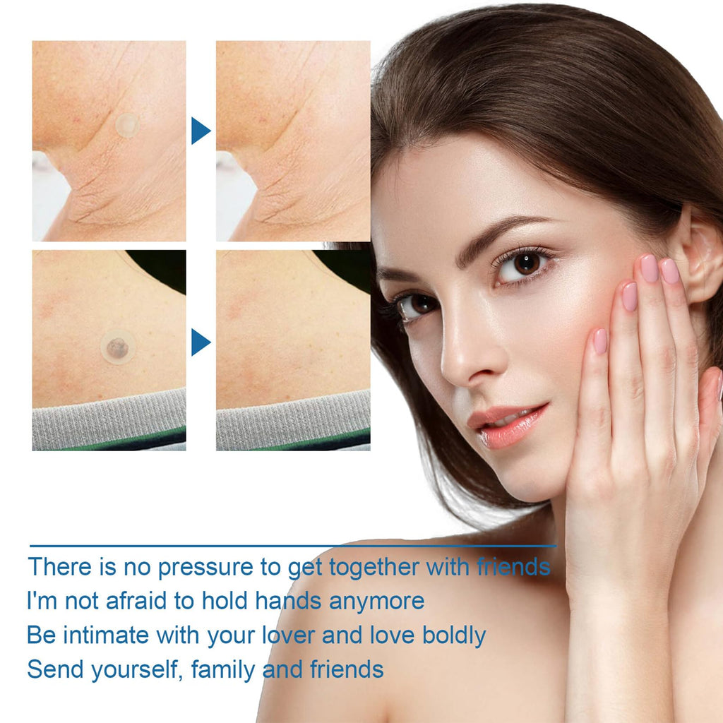 MrCuvaryas 180pc Skin Tag Remover Patches - Wart, Mole, Acne Spot Treatment for Face, Finger, Arm, Leg - Damaged Box