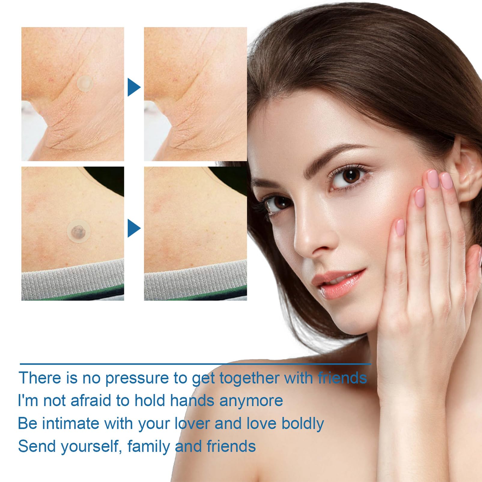 MrCuvaryas 180pc Skin Tag Remover Patches - Wart, Mole, Acne Spot Treatment for Face, Finger, Arm, Leg - Damaged Box