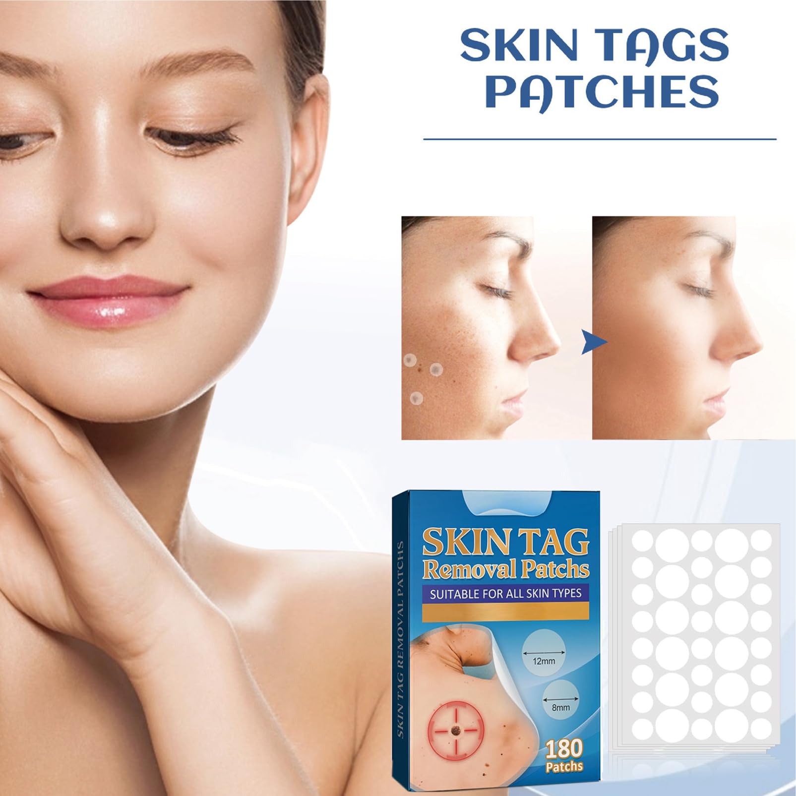 MrCuvaryas 180pc Skin Tag Remover Patches - Wart, Mole, Acne Spot Treatment for Face, Finger, Arm, Leg - Damaged Box
