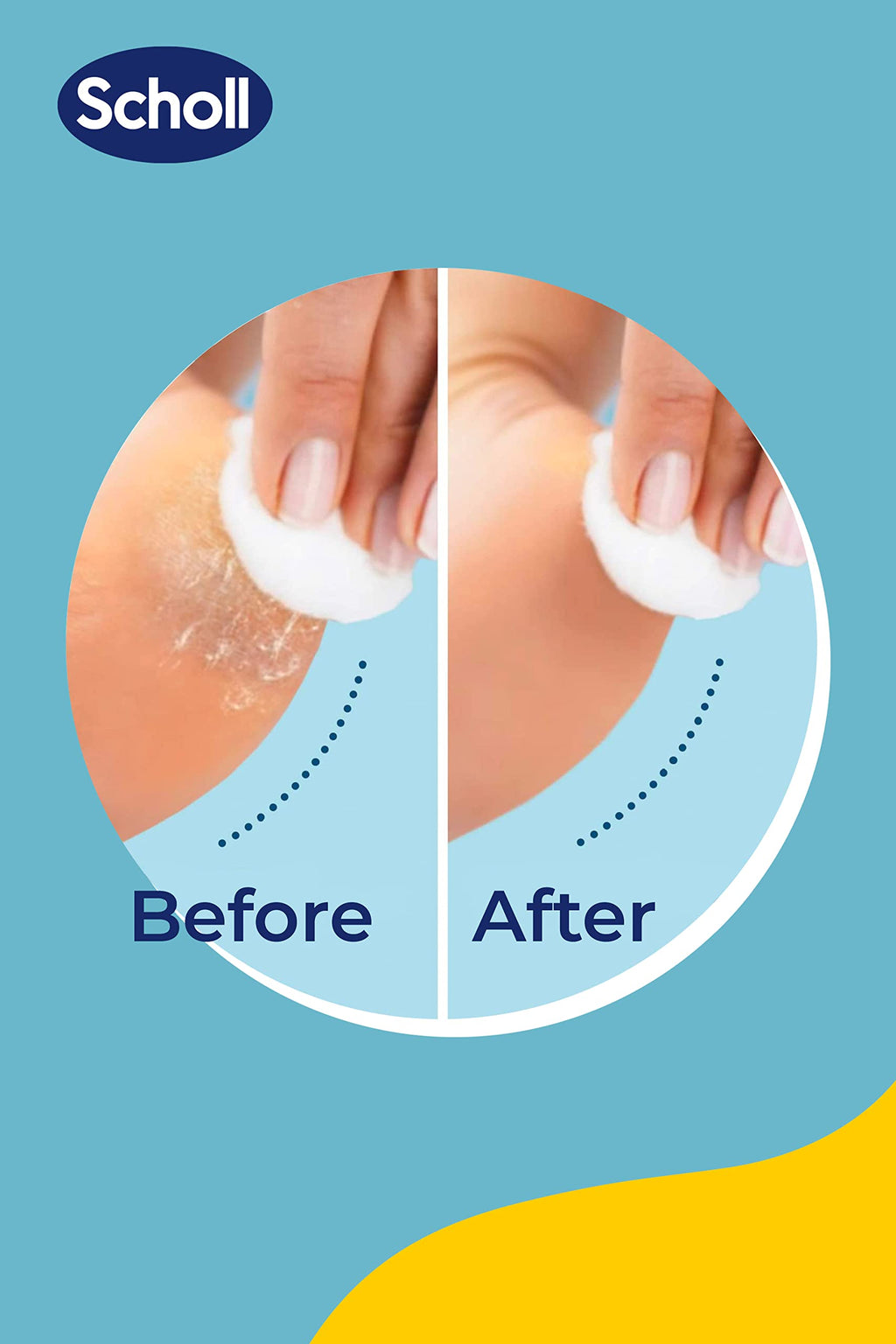 Scholl Expert Care 2-in-1 File & Smooth Foot File Refills - 2x Replacement Roller Heads for Pedicure - Damaged Box