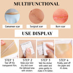 Prreal Tattoo Cover Up Patch - 8 Pcs Waterproof Invisible Body Concealer Sticker - Light Skin Tone - Damaged Box