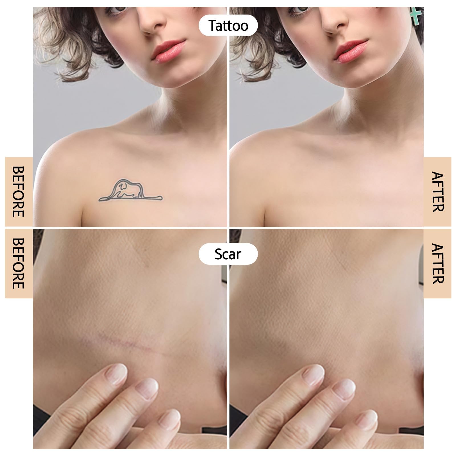 Prreal Tattoo Cover Up Patch - 8 Pcs Waterproof Invisible Body Concealer Sticker - Light Skin Tone - Damaged Box