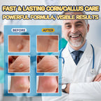 Extra Strength Liquid Corn Remover for Feet - Fast Acting 20ml 1-Pack - Damaged Box